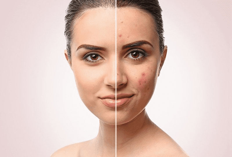 Kem ngừa thâm Magic Skin – Anti Bruise Cream 2