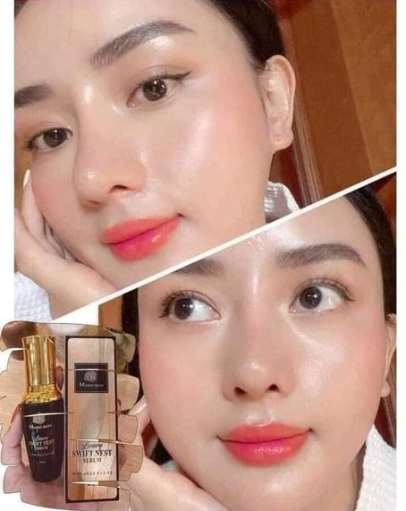 Mụn đầu đen: Tại sao lại xuất hiện và cách để ngăn chặn chúng? 3