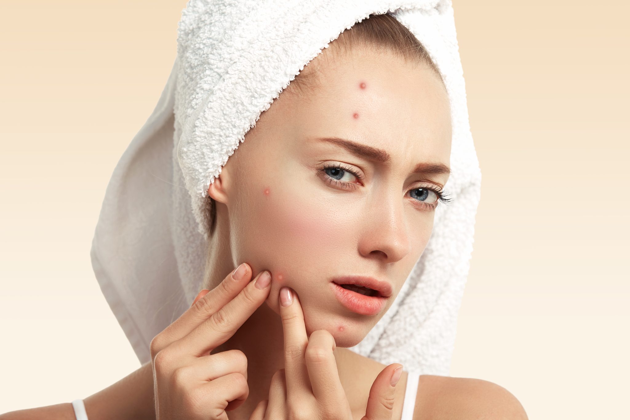 Mụn bọc: Nguyên nhân, triệu chứng và cách điều trị