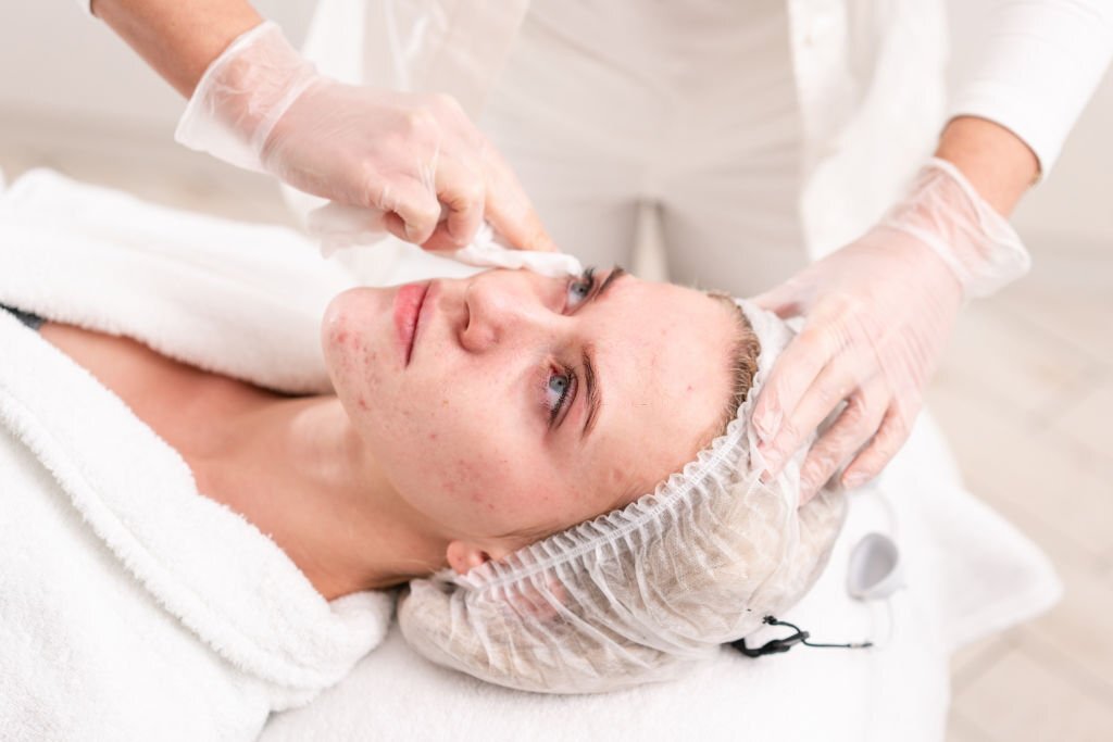 Mụn bọc: Nguyên nhân, triệu chứng và cách điều trị 3